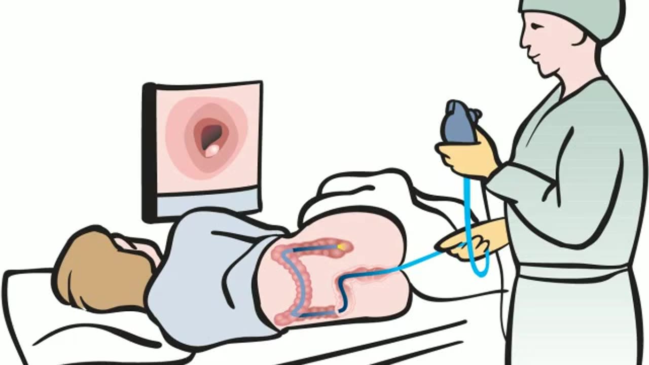 DIY COLONOSCOPY! (from Feb 2016)