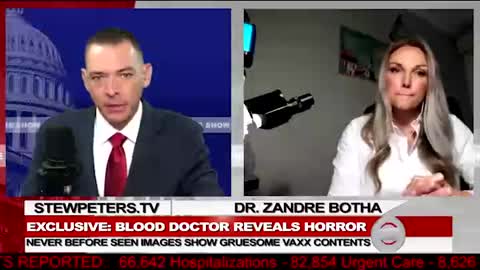 analisis vial_2 STEW PETERS DRA