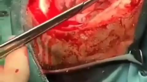 ΕΜΒΟΛΙΑΣΜΕΝΟΣ.ΠΡΟΣΟΧΗ ΣΚΛΗΡΕΣ ΕΙΚΟΝΕΣ