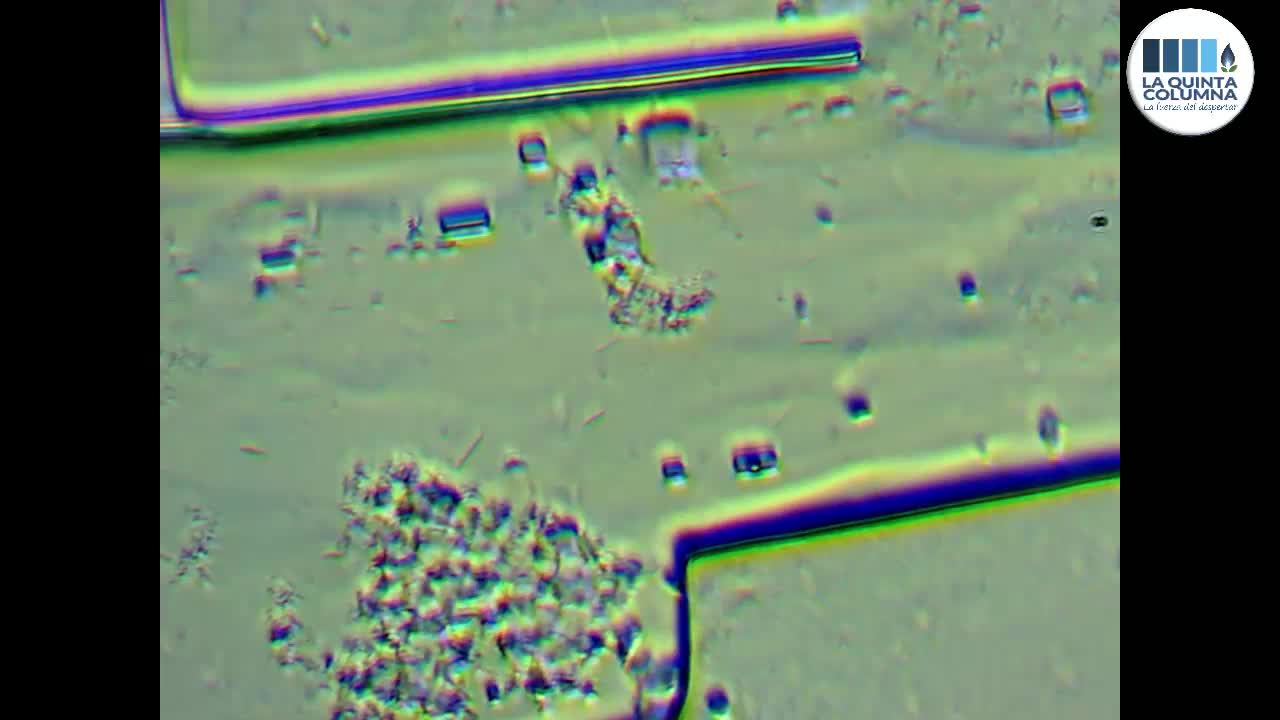 Le immagini dei Nanochip nei vaccini