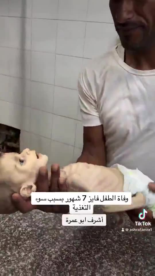 ONLY ONE SIDE STARVES BABIES