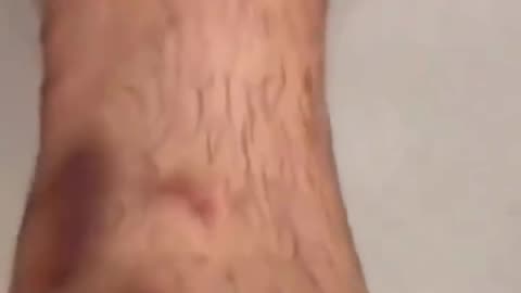 A 13-year-old Palestinian child has revealed the physical toll he endured