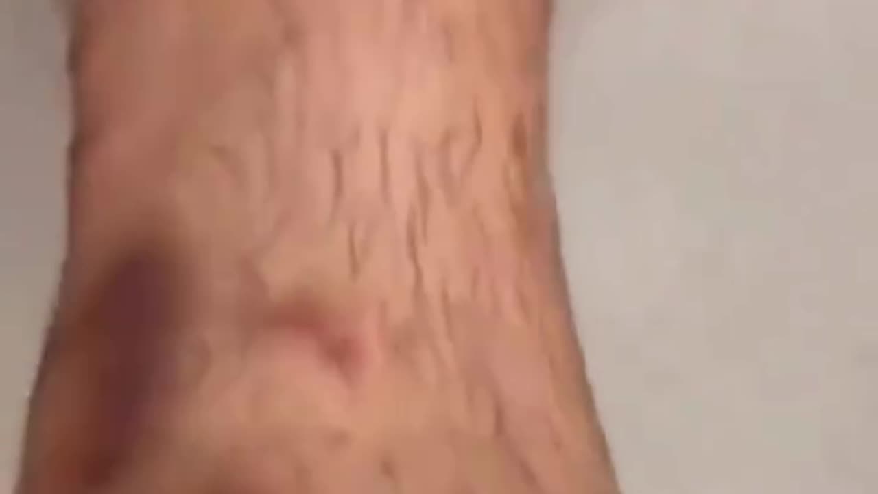 A 13-year-old Palestinian child has revealed the physical toll he endured
