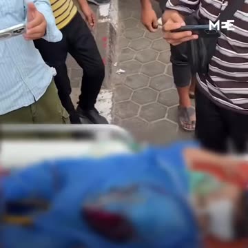 Child injured after Israeli strike targeted a group of civilians in Gaza