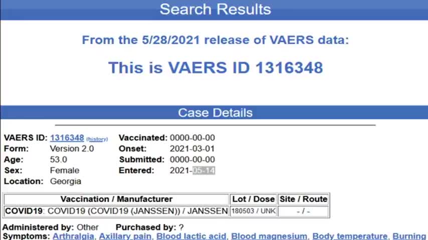 VACCINE GENOCIDE - CDC Removes 150k Deaths From VAERS System