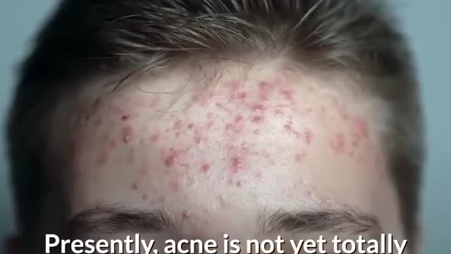 8 simple skin care tips
