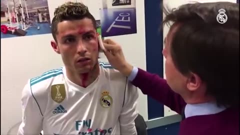 Ronaldo's injury incident