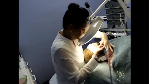 Fotofacial Laser Skin Resurfacing | Ppsofne.com