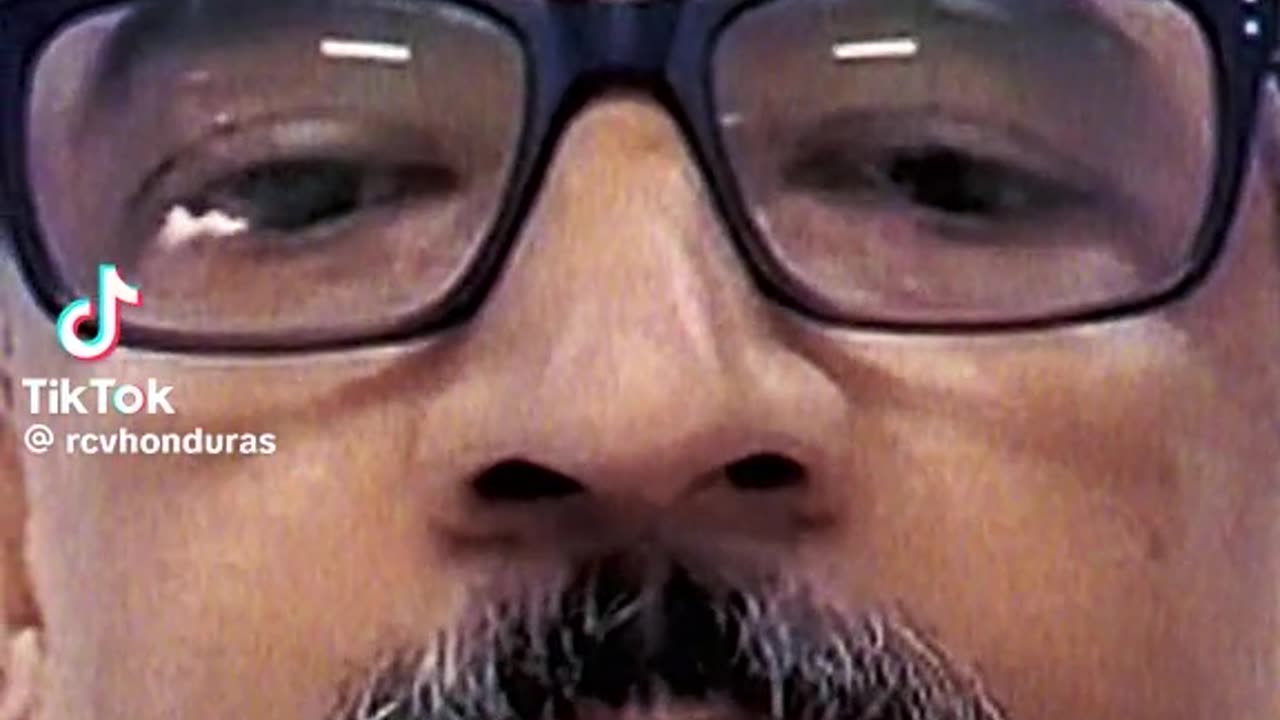 Dr Fredy Portillo y las camaras en los quirofanos