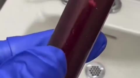 The specifics of Vaxxblood?