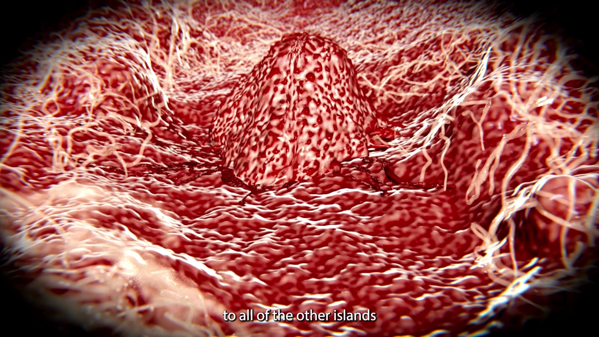 Why Is Cancer Strengthened By Surgery