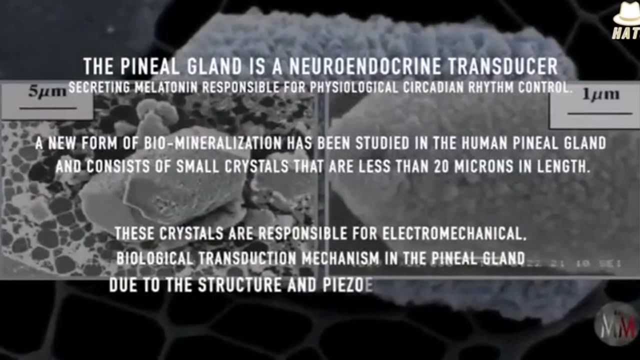 Pineal Gland