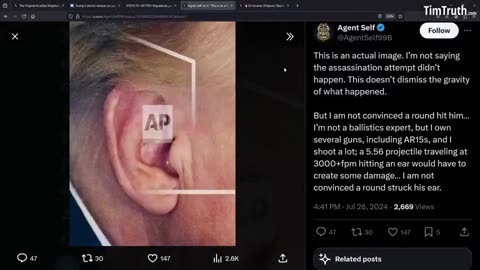 THE EAR REVEAL! TRUMP SHOOTING HOAX 🔥🔥🔥