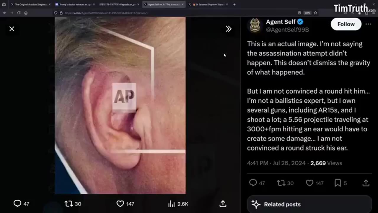 THE EAR REVEAL! TRUMP SHOOTING HOAX 🔥🔥🔥