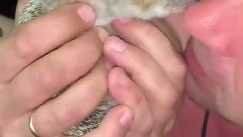 Hedgehog Bites Man's Nose When He Gets It Close to His Face