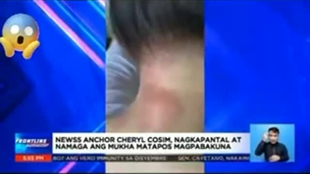 Serious Adverse Event - Cheryl Cosim