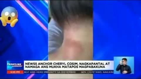 Serious Adverse Event - Cheryl Cosim