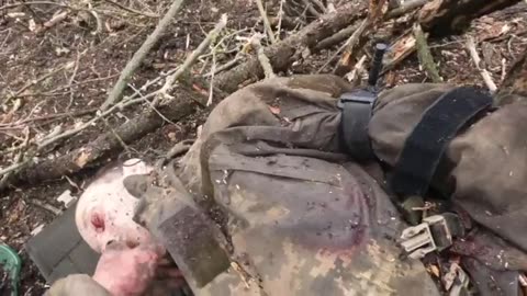 Video of the work of a combat medic after an artillery strike on Russian forces..