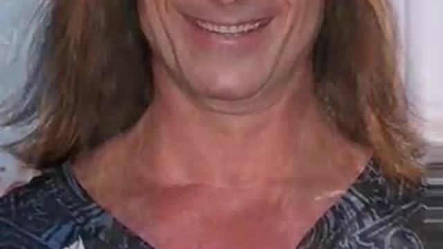 Fabio Lanzoni before and after