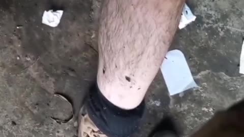 Wounded Ukrainian soldiers in Bakhmut