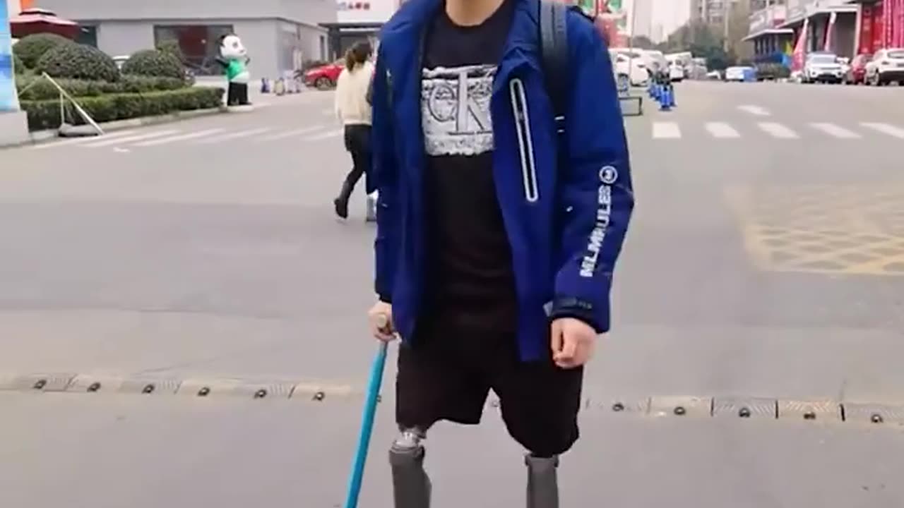 Man with two prosthetic legs is living life without limits! 👏