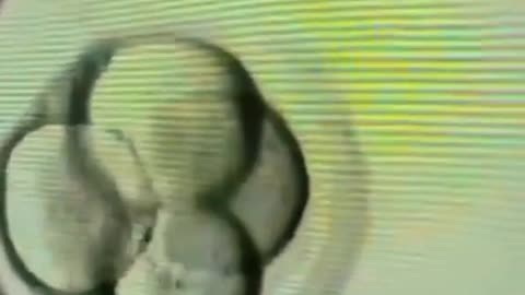 Test tube baby: embryo division under microscope