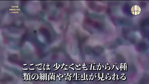 なんて クレイジー な ワクチン ｍRNA💉接種者血液から 寄生虫 と 卵が見つかる