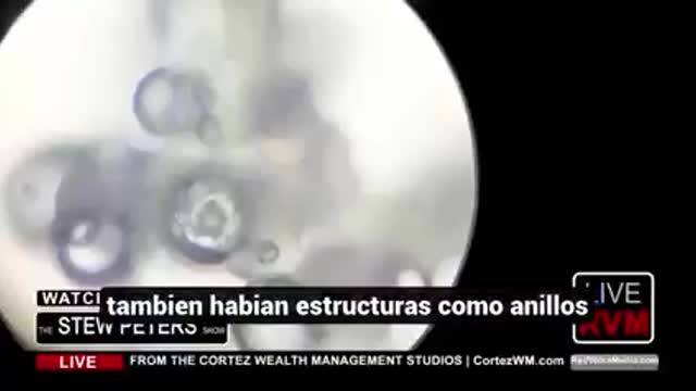 LA DOCTORA OBSERVO EN LOS VIALES TECNOLOGÍA Y ORGANISMOS VIVOS