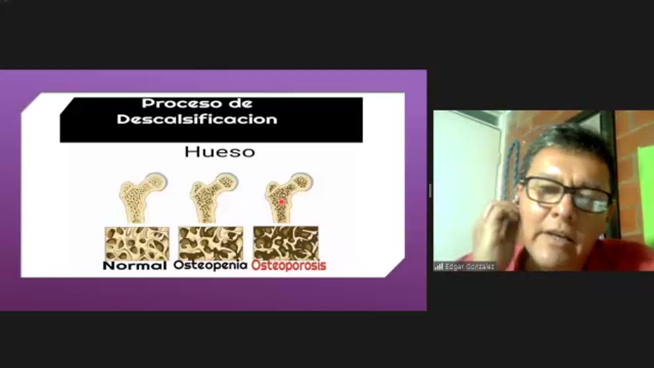 #HGW | Descalcificación Osteoporosis | Recomendación de Productos HGW