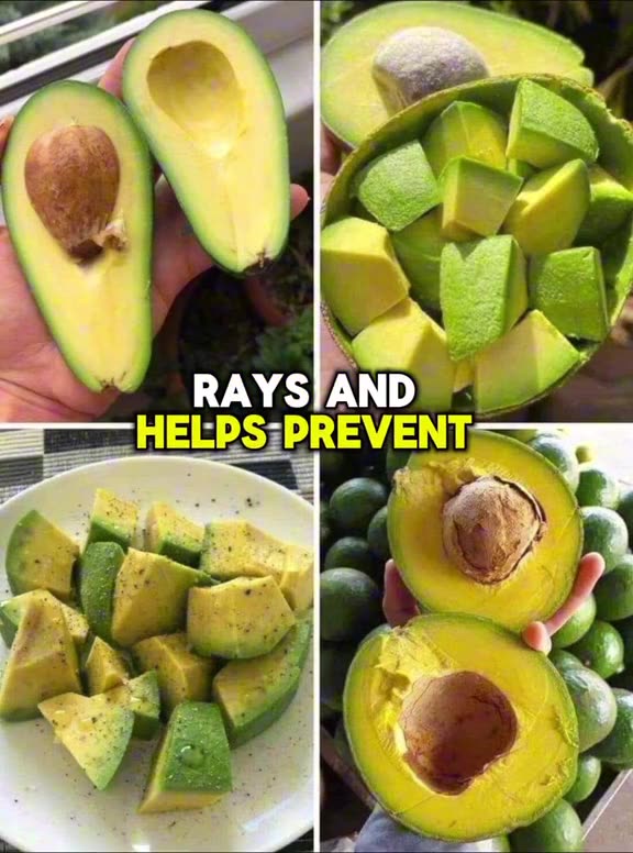 natural benefits of adding avocado to your daily diet