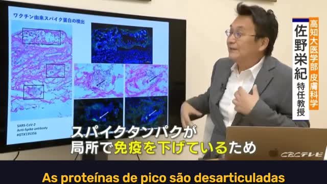 O Japão está falando sobre as Reações Adversas Graves causadas pelas 💉 de mRNA.