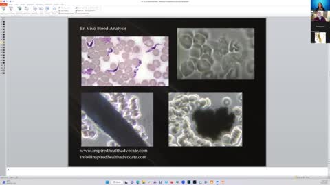 EDTA Detoxification for Metals, Graphene and Hydrogel