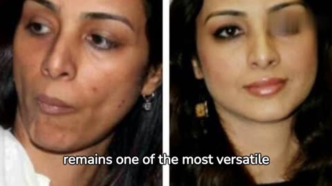 Embracing Natural Beauty: 5 Bollywood Actresses Who Shine Without Plastic Surgery