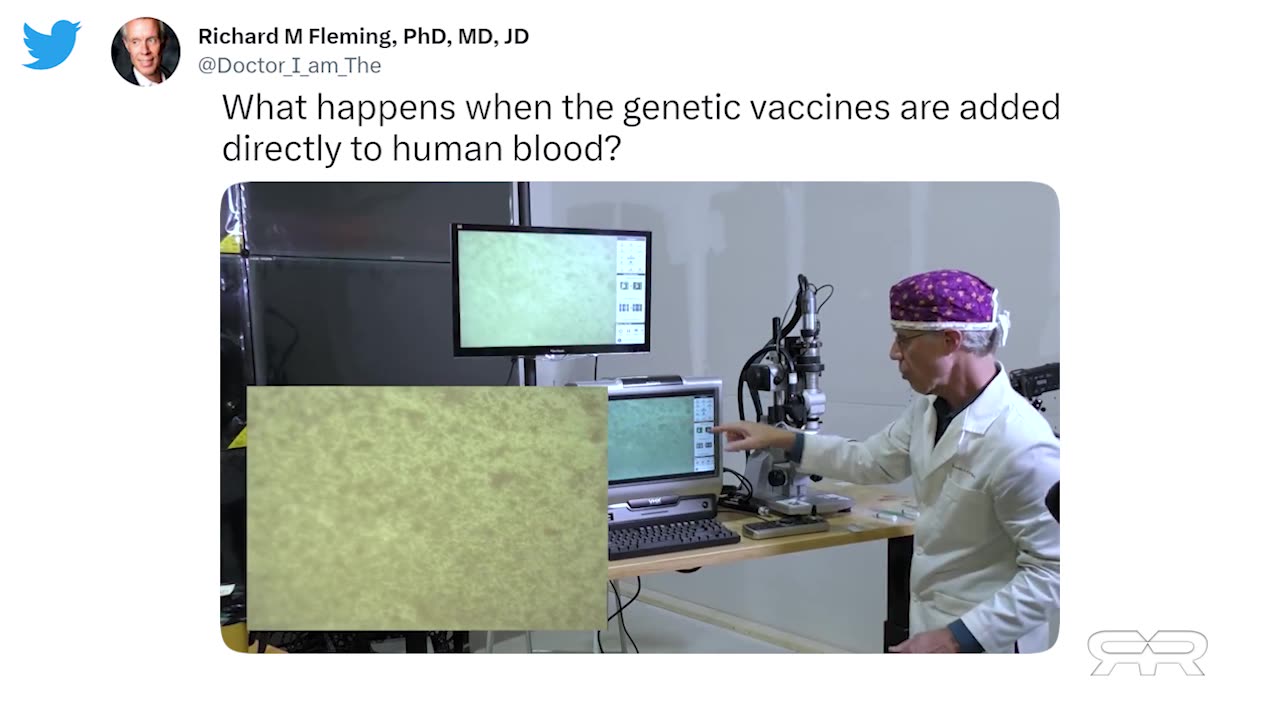 Thermographic imaging shows massive blood clots in the asymptomatic vaxxed.