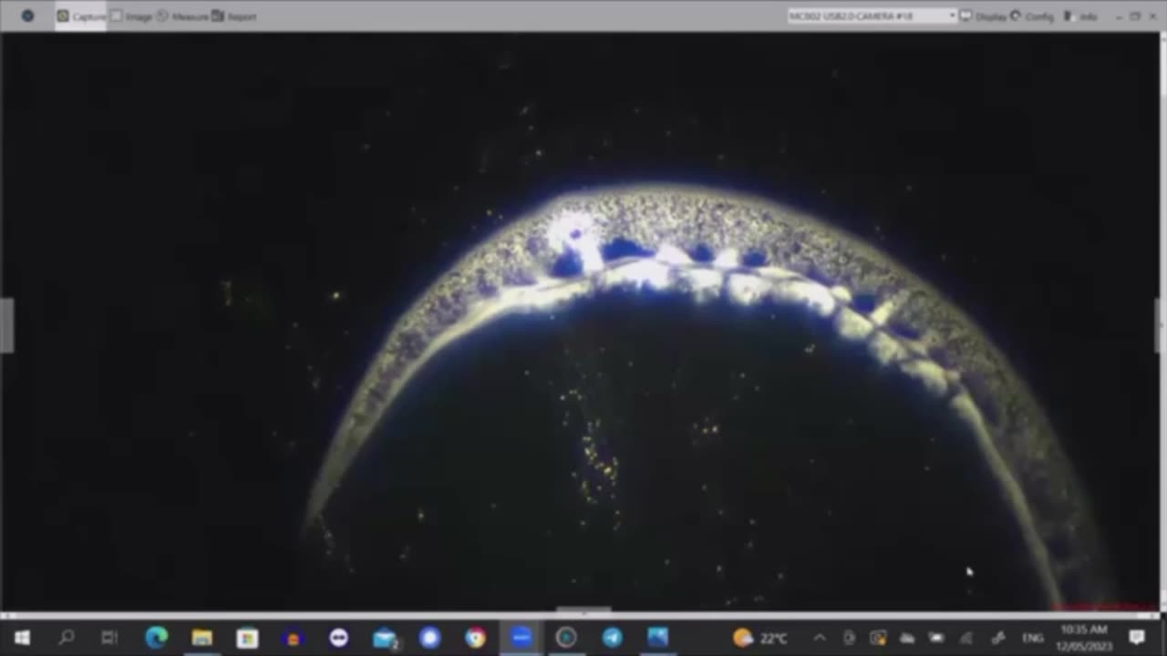 WARNING nano graphene hydrogels on dental anaesthetics