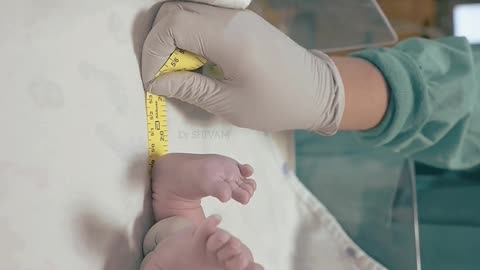 Very beautiful moment after birth of baby 🐥🐥