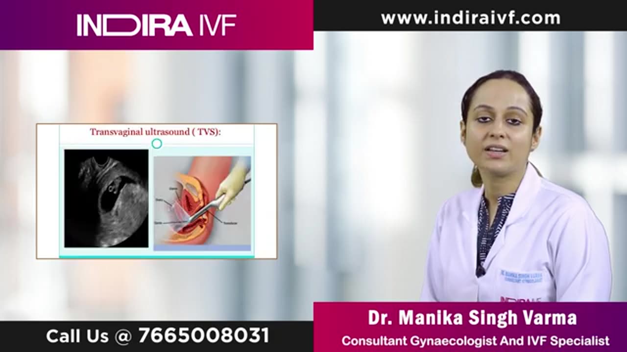 IUI Treatment: Everything to Know About Intrauterine Insemination at Indira IVF