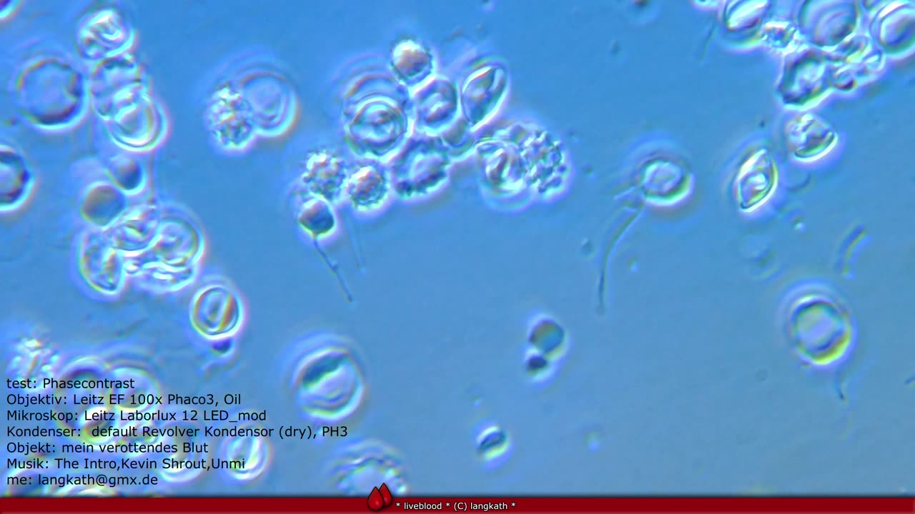 microscope phasecontrast-test my rottin' blood , Acanthocytes (spur cells)