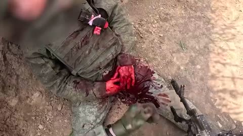 Russian Soldier Bleeding Out