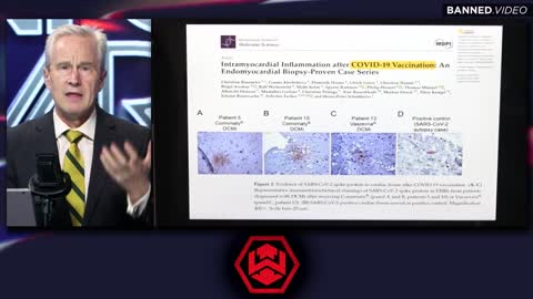 דר פיטר מק'קולו מוציא אזהרת חירום על חיסוני הקורנה