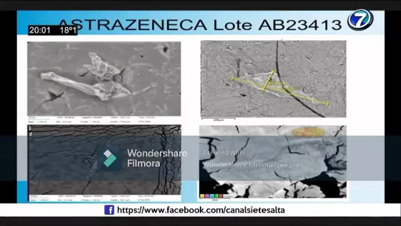 Bióloga Marcela Sangorrín, Viales al microscopio