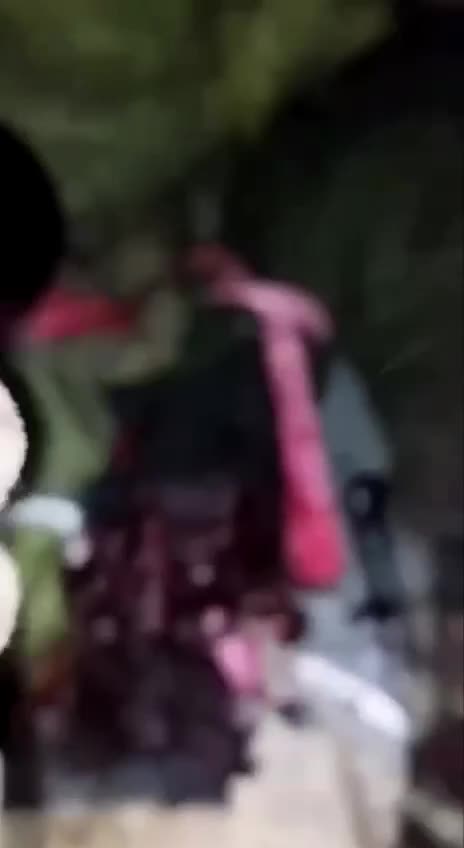 Amputating the Arm of a Russian Soldier with a Pocket Knife