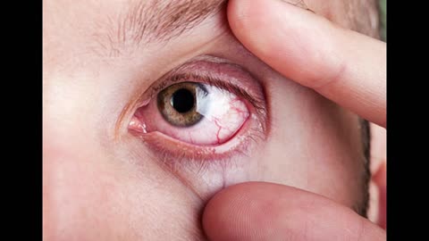 Massage Your Eyes like THIS & Wake Up with Better Eyesight Tomorrow