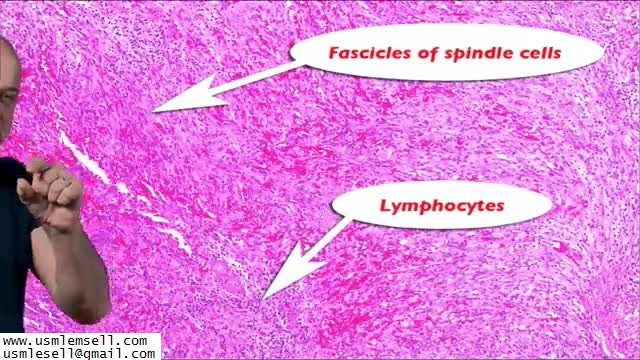 Infectious Disease - Section 1 - MedQuest