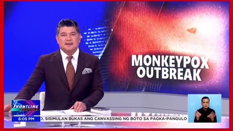 Monkeypox, kumakalat nasa iba't ibang bansa三