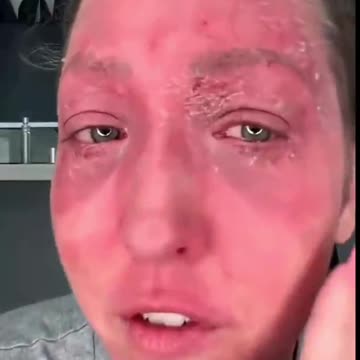 Three Vaccines later, 'I was just following doctor orders'