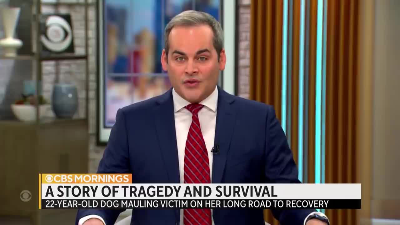 "It's time to show who I am now": Dog sitter recovering after losing face in horrific dog attack