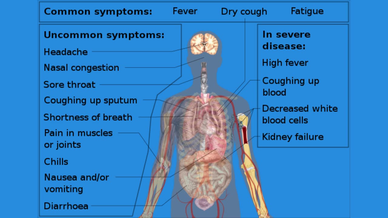 Three in five long COVID patients have organ damage a year after infection