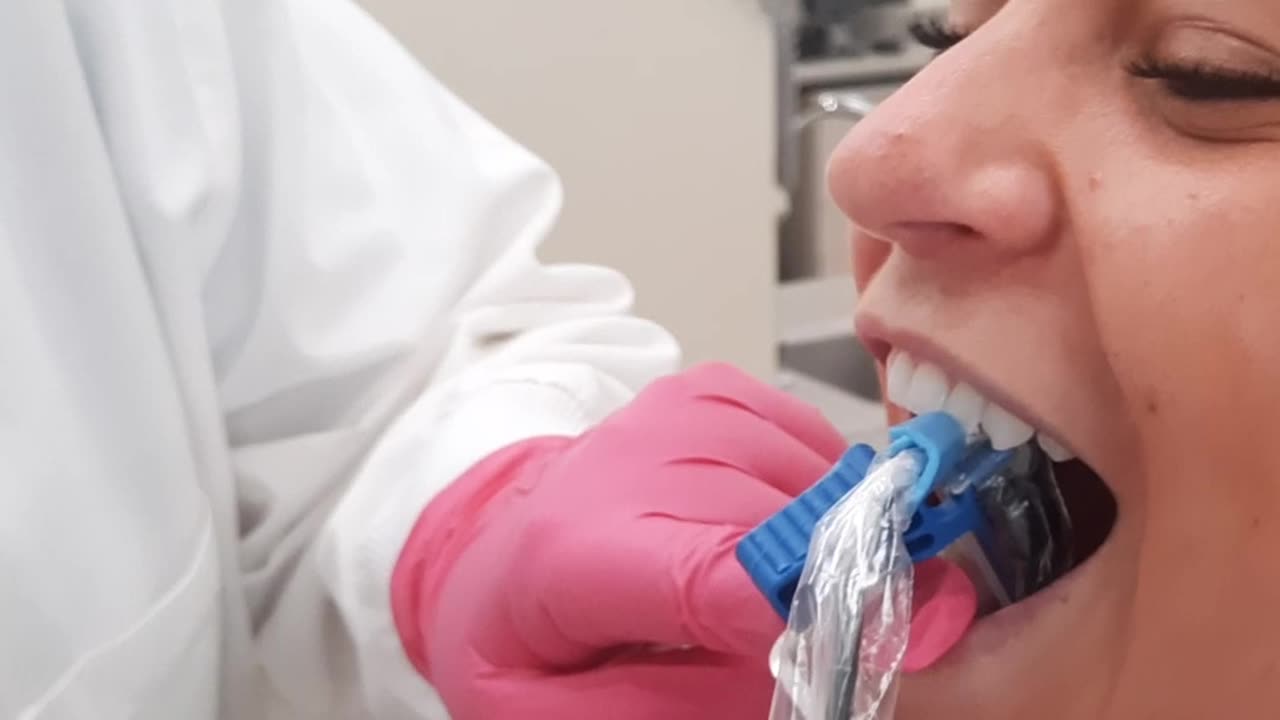 Mandibular Anterior PA Sensor Placement