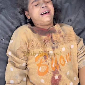 Children injured during Israeli bombing of Gaza